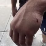 Frampton fight off after freak accident in hotel