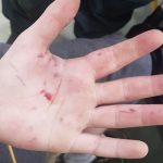 Boy (14) injured after firework is thrown at him